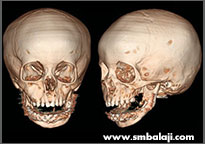 Postoperative CT scan image