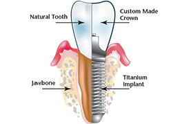 Balaji Dental Hospital,Chennai,India