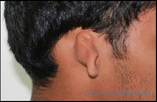 Jaqw deformity surgery - Balaji Dental